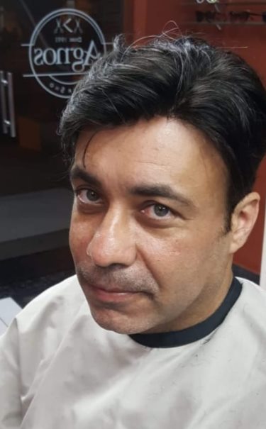 Mesmo cliente depois da prótese capilar, com o topo coberto e cabelo natural